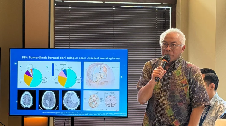 Dokter Spesialis Bedah Saraf Ungkap Tak Semua Tumor Otak Harus Dioperasi