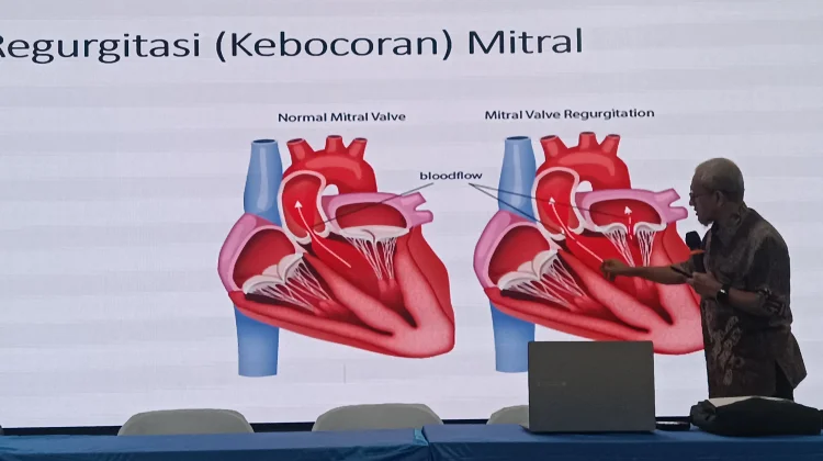 Primaya Hospital Hadirkan MitraClip untuk Atasi Kebocoran Katup Jantung