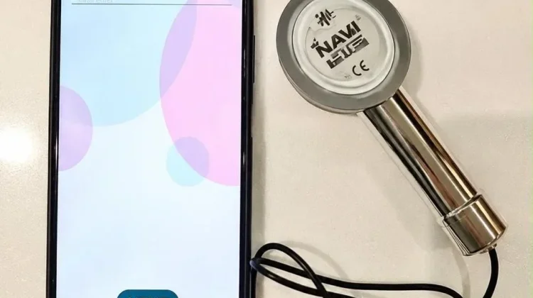 Inovasi AI Karya Dokter Indonesia Berpotensi Bantu Deteksi Dini Gagal Jantung