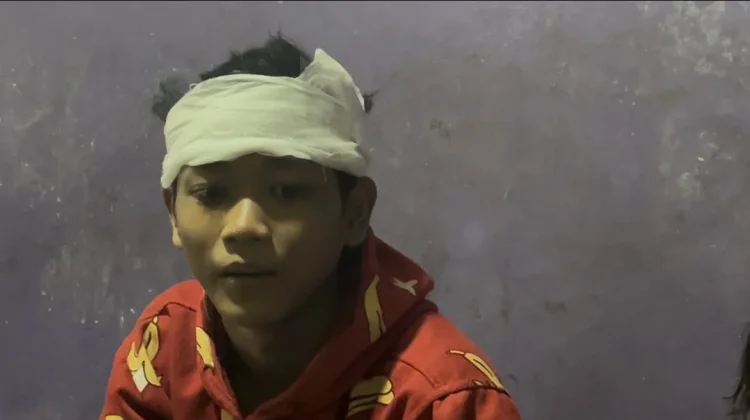Pelajar Dibacok Sekelompok Bermotor di Palmerah, Alami Tiga Jahitan di Kepala
