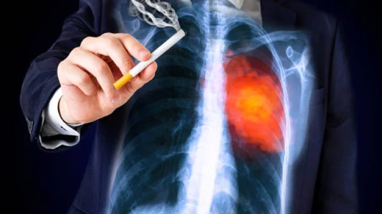 Rokok Disebut Perburuk Kesehatan Mental dan Ancam Tumbuh Kembang Anak