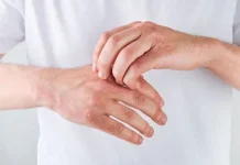 Cara Mengatasi Kulit Kering agar Tetap Lembab