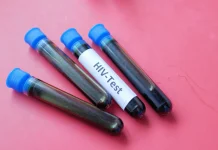 Stigma terhadap HIV dan TBC Dinilai Masih Jadi Hambatan Pengobatan Pasien