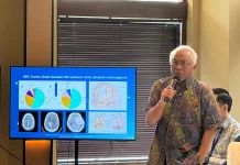 Dokter Spesialis Bedah Saraf Ungkap Tak Semua Tumor Otak Harus Dioperasi
