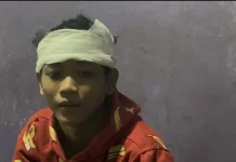 Pelajar Dibacok Sekelompok Bermotor di Palmerah, Alami Tiga Jahitan di Kepala