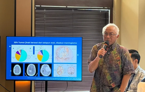 Dokter Spesialis Bedah Saraf Ungkap Tak Semua Tumor Otak Harus Dioperasi