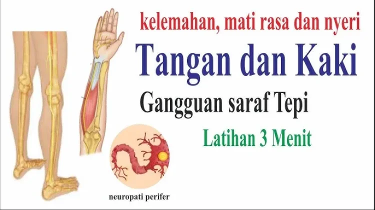 Jangan Biarkan Gejala Kerusakan Saraf Tepi Berlarut