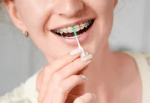Interdental Brush, Alat Kecil Penyelamat Pengguna Behel