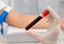 Warna Darah Merah Gelap Bukan Tanda Darah Kotor