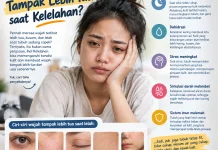 Penyebab Wajah Tampak Lebih Tua saat Tubuh Kelelahan