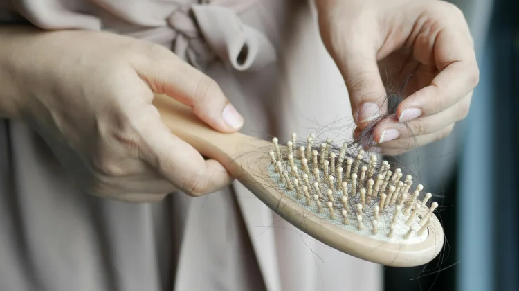 Rambut Rontok Pascamelahirkan Fakta Medis atau Sekadar Mitos?