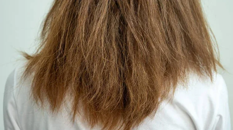 Penyebab dan Cara Merawat Rambut Kering, Ini Kiatnya