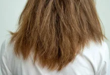 Penyebab dan Cara Merawat Rambut Kering, Ini Kiatnya