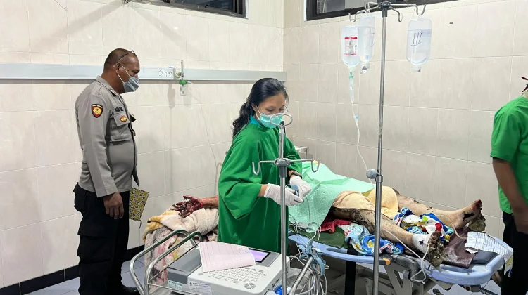 Suami di Gambiran Banyuwangi Bakar Istri, Dipicu Cekcok