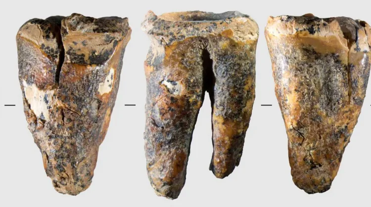 Neanderthal Diduga Melakukan Operasi Gigi 59 Ribu Tahun Lalu