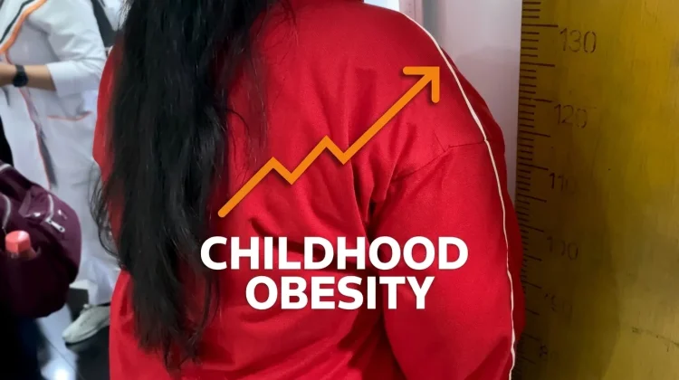 Jadi Sasaran Bullying, Ahli Ingatkan Dampak Obesitas Anak Tak Cuma Soal Fisik
