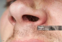 Manfaat Penting Bulu Hidung Bagi Kesehatan Pernapasan