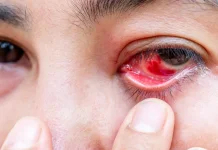 Jangan Sepelekan Diabetes, Risiko Kebutaan Mengintai
