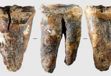 Neanderthal Diduga Melakukan Operasi Gigi 59 Ribu Tahun Lalu