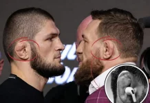 Cauliflower Ear, "Lencana" Kehormatan Bagi Para Petarung MMA