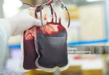 Berapa Lama Jeda Waktu Aman Antar Donor Darah?