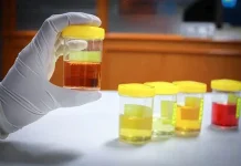 Waspada Warna Urine, Tanda Resiko Kesehatan Sering Diabaikan