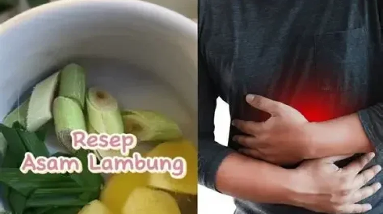 Cara Mengobati Asam Lambung dengan Cepat dan Alami