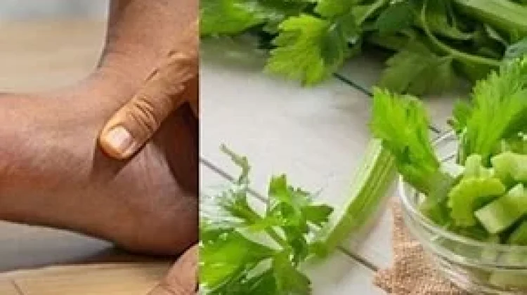 Lima Pilihan Obat Asam Urat Alami yang tanpa Efek Samping