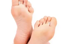 Tanda Kanker Serviks dari Telapak Kaki dan Pengobatannya