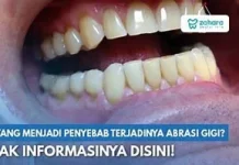 Abrasi Gigi, Kenali Penyebab dan Cara Mengatasinya