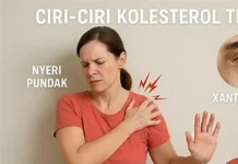 Tujuh Ciri-Ciri Kolesterol Naik yang Harus Diwaspadai