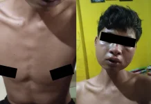 Anak di Bawah Umur Diduga Disulut Rokok dan Disetrum Oknum Anggota Polres Wakatobi