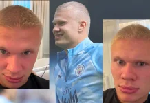 Erling Haaland Pangkas Rambut Jadi Botak ?