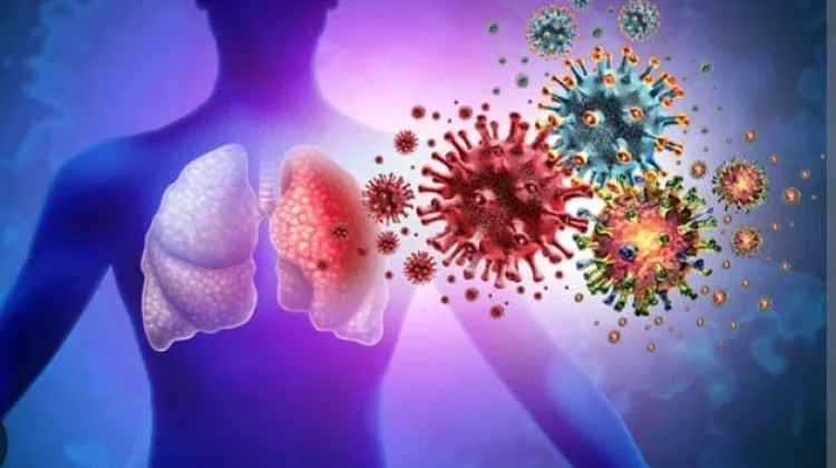 Bahaya Pneumonia Pada Bayi