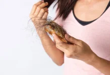 Cara Mengobati Rambut Rontok dan Kebotakan Dini Secara Efektif