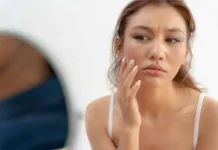 Langkah Pertama Hadapi Kulit Kusam