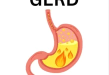 Makanan untuk Meredakan GERD Secara Alami