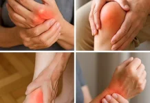 Mengenal Apa Itu Pengapuran Tulang atau Osteoartritis
