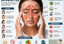 Bahaya Sinusitis: Kenali Gejala, Penyebab, dan Cara Mencegahnya