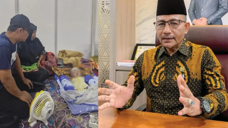 Bayi Hidrosefalus Asal Bireuen Gagal Operasi Haji Uma Turun Tangan