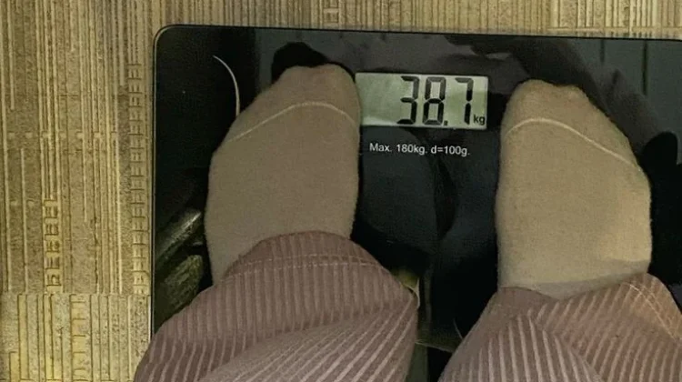 Berat Badan Ideal, Kunci Sehat bagi Pria dan Wanita