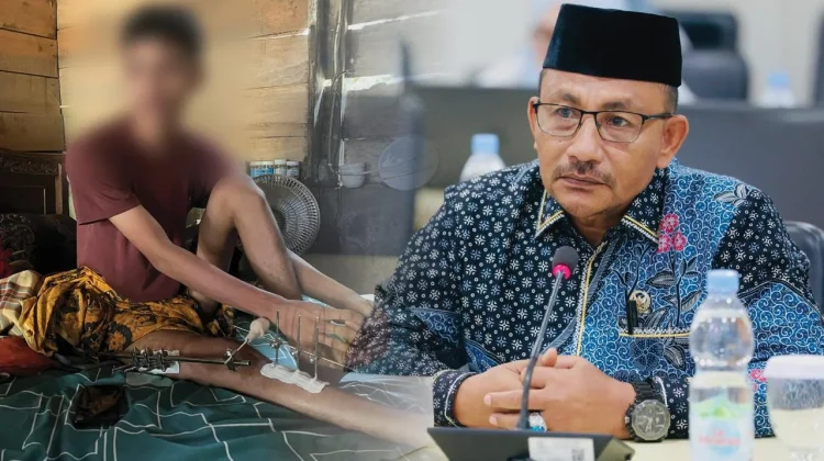 Haji Uma Tanggung Biaya Pendampingan Pasien Patah Kaki Asal Bireuen