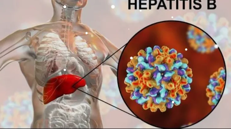 Sebanyak 6,7 Juta Warga Indonesia Terinfeksi Hepatitis B, Waspadai Risikonya