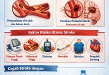 Penyebab Utama Stoke yang Perlu Diketahui