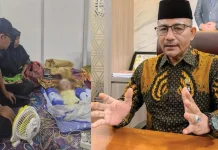 Bayi Hidrosefalus Asal Bireuen Gagal Operasi Haji Uma Turun Tangan