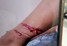 Insiden Biawak di Kantor Bulog, Satu Warga Terluka