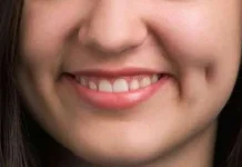 Lesung Pipi, Ciri Unik Wajah yang Penuh Fakta Menarik
