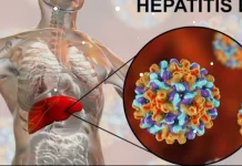 Sebanyak 6,7 Juta Warga Indonesia Terinfeksi Hepatitis B, Waspadai Risikonya
