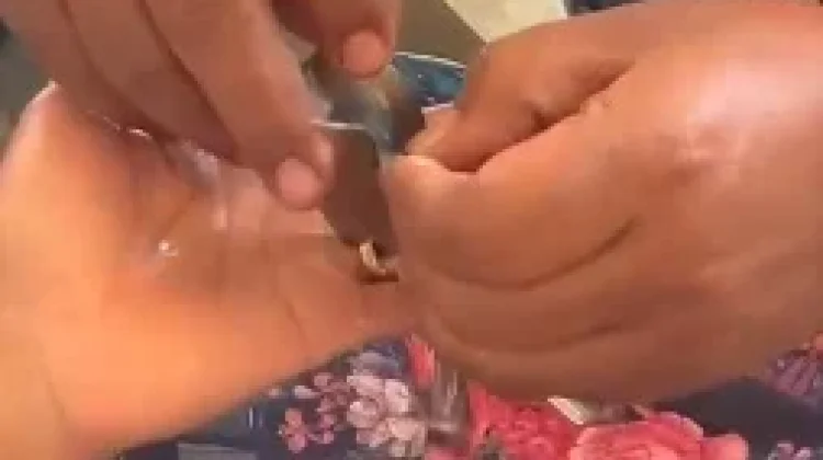 Petugas Damkar Ponorogo Bantu Evakuasi Cincin Terjepit di Jari