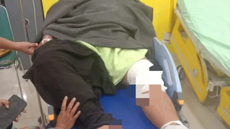 Seorang Personel Damkar Alami Luka Bakar saat Padamkan Kebakaran